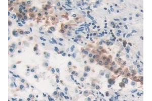 Detection of MVP in Human Lung Tissue using Polyclonal Antibody to Major Vault Protein (MVP)