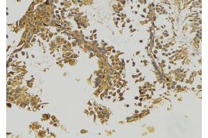 ABIN6273382 at 1/100 staining RAT testis tissue by IHC-P.