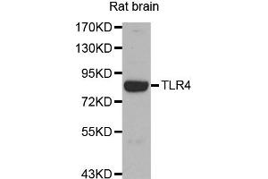 Western blot analysis of Rat brain tissue lysate using TLR4 antibody. (TLR4 anticorps)