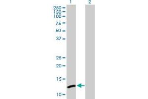 Western Blot analysis of C1orf38 expression in transfected 293T cell line by C1orf38 MaxPab polyclonal antibody. (C1orf38 anticorps  (AA 1-132))