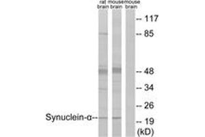 Western blot analysis of extracts from rat brain/mouse brain cells, using Synuclein-alpha (Ab-125) Antibody. (SNCA anticorps  (AA 86-135))