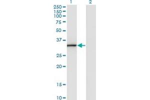 Western Blotting (WB) image for anti-Annexin A3 (ANXA3) (AA 1-324) antibody (ABIN961139) (Annexin A3 anticorps  (AA 1-324))