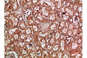 Immunohistochemical analysis of paraffin-embedded human-kidney, antibody was diluted at 1:200