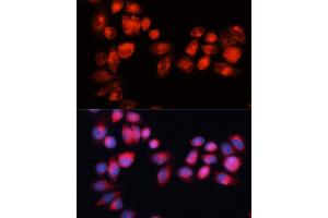 Immunofluorescence analysis of HeLa cells using  antibody (ABIN7265735) at dilution of 1:100 (40x lens). (ABCB7 anticorps  (AA 503-753))