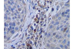 Image no. 1 for anti-Colony Stimulating Factor 1 (Macrophage) (CSF1) antibody (ABIN465552) (M-CSF/CSF1 anticorps)