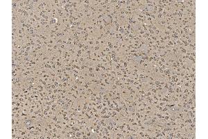 IHC analysis of EIF5 using anti-EIF5 antibody (ABIN7599722). (EIF5 anticorps  (AA 11-423))