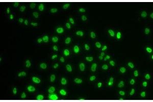 Immunofluorescence analysis of MCF-7 cells using PHIP Polyclonal Antibody