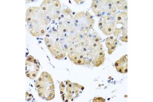 Immunohistochemistry of paraffin-embedded human stomach using NUMA1 antibody. (NUMA1 anticorps)