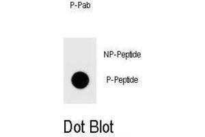 Dot Blot (DB) image for anti-Platelet-Activating Factor Acetylhydrolase 1b, Catalytic Subunit 2 (30kDa) (PAFAH1B2) antibody (ABIN3001954)