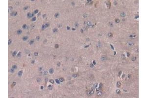 IHC-P analysis of Mouse Cerebrum Tissue, with DAB staining. (M-CSF/CSF1 anticorps  (AA 33-204))