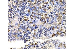 Immunohistochemistry of paraffin-embedded Rat spleen using UBE2V2 Polyclonal Antibody at dilution of 1:100 (40x lens). (UBE2V2 anticorps)