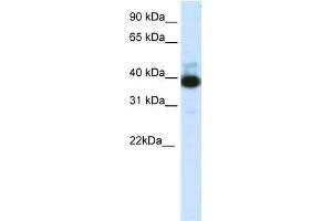 WB Suggested Anti-TTC19 Antibody Titration:  1. (TTC19 anticorps  (C-Term))