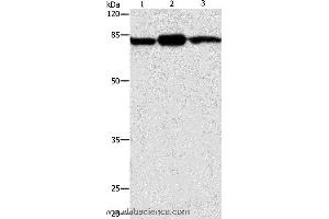 Western blot analysis of Mouse brain and skin tissue, 293T cell , using CAPN2 Polyclonal Antibody at dilution of 1:200 (Calpain 2 anticorps)