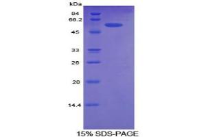 SDS-PAGE analysis of Human ALCAM Protein. (CD166 Protéine)