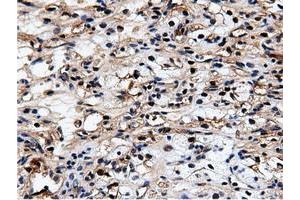 Image no. 1 for anti-5'-Nucleotidase Domain Containing 1 (NT5DC1) antibody (ABIN1499836)