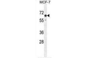 CO027 Antibody (C-term) western blot analysis in MCF-7 cell line lysates (35µg/lane). (C15orf27 anticorps  (C-Term))