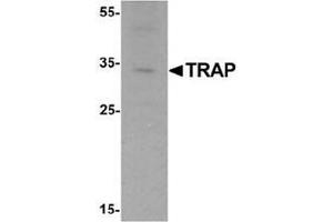 Western blot analysis of TRAP in mouse brain tissue lysate with TRAP Antibody  at 1 ug/mL. (ACP5 anticorps  (C-Term))