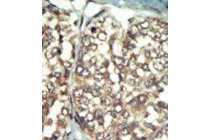 Image no. 2 for anti-Phosphatidylinositol 4-Kinase Type 2 beta (PI4K2B) (C-Term) antibody (ABIN360474)
