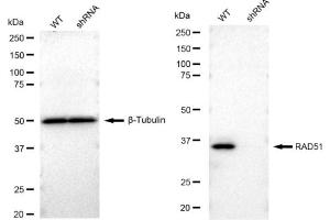 Western blotting analysis using RAD51 antibody (ABIN7798366). (Recombinant RAD51 anticorps)