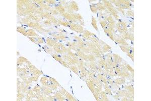 Immunohistochemistry of paraffin-embedded Mouse heart using EIF2S1 Polyclonal Antibody at dilution of 1:100 (40x lens). (EIF2S1 anticorps)