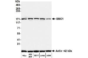 Western Blotting (WB) image for anti-Structural Maintenance of Chromosomes 1A (SMC1A) (C-Term) antibody (ABIN7455193) (Recombinant SMC1A anticorps  (C-Term))
