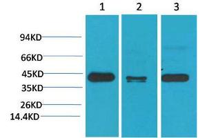 Western Blot (WB) analysis of 1) HeLa, 2)Mouse Brain Tissue, 3) Rat Brain Tissue with TBP/TATA Binding Protein Mouse Monoclonal Antibody diluted at 1:2000. (TBP anticorps)