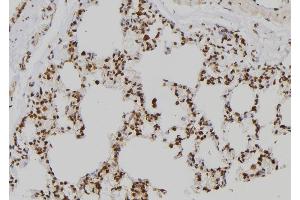 ABIN6273562 at 1/100 staining Rat lung tissue by IHC-P. (ZNF440 anticorps)
