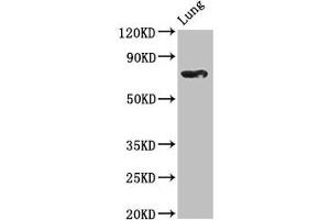 Western Blot Positive WB detected in: Rat lung tissue All lanes: TBX2 antibody at 2. (TBX2 anticorps  (AA 299-573))