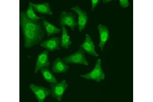 Immunofluorescence analysis of A549 cells using CDC5L antibody. (CDC5L anticorps)
