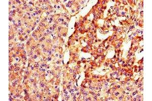 Immunohistochemistry of paraffin-embedded human pancreatic tissue using ABIN7152495 at dilution of 1:100 (BTRC anticorps  (AA 397-448))