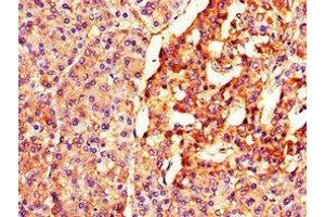 Immunohistochemistry of paraffin-embedded human pancreatic tissue using ABIN7152495 at dilution of 1:100