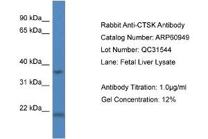 Western Blotting (WB) image for anti-Cathepsin K (CTSK) (Middle Region) antibody (ABIN2788629) (Cathepsin K anticorps  (Middle Region))