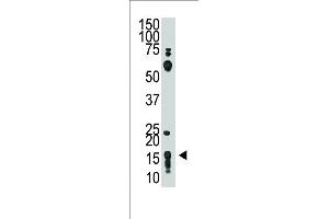 The anti-THY1 (N-term) Pab (ABIN388803 and ABIN2839126) is used in Western blot to detect THY1 in HL60 cell lysate.