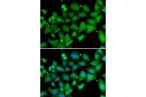 Immunofluorescence analysis of MCF-7 cells using RBBP7 antibody. (RBBP7 anticorps)