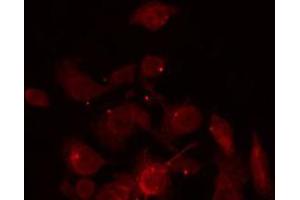 ABIN6266928 staining Hela by IF/ICC. (ZNF187 anticorps  (Internal Region))