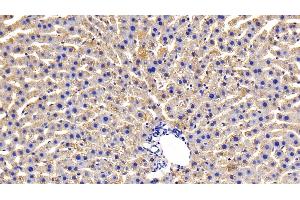 Detection of OSMR in Rat Liver Tissue using Polyclonal Antibody to Oncostatin M Receptor (OSMR) (Oncostatin M Receptor anticorps  (AA 503-749))
