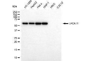 Western blotting analysis using LPCAT1 antibody (ABIN7799305).