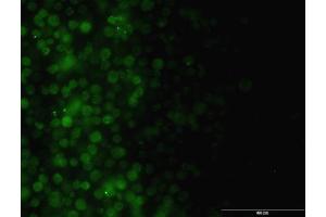 Immunofluorescence of monoclonal antibody to ILK on Jurkat cell. (ILK anticorps  (AA 341-452))