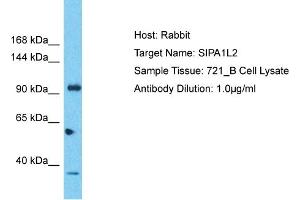 Host: Rabbit Target Name: SIPA1L2 Sample Tissue: Human 721_B Whole Cell Antibody Dilution: 1ug/ml (SIPA1L2 anticorps  (C-Term))