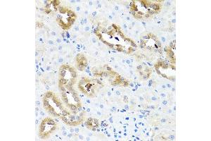Immunohistochemistry of paraffin-embedded rat kidney using FABP5 antibody at dilution of 1:100 (x40 lens). (FABP5 anticorps)