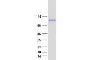 Validation with Western Blot