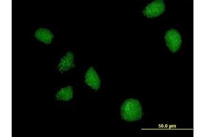 Immunofluorescence of purified MaxPab antibody to C21orf7 on HeLa cell. (MAP3K7CL anticorps  (AA 1-242))