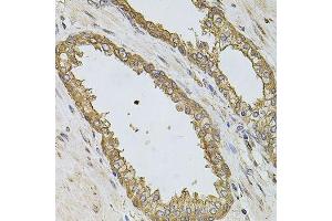 Immunohistochemistry of paraffin-embedded human prostate using PIK3CA antibody.