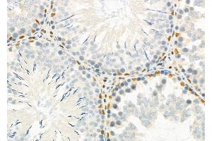 ABIN6262224 and ABIN6266867 at 1/100 staining Rat testis tissue by IHC-P. (HEXIM1 anticorps)