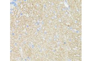 Immunohistochemistry of paraffin-embedded Mouse brain using THY1 Polyclonal Antibody at dilution of 1:100 (40x lens). (CD90 anticorps)
