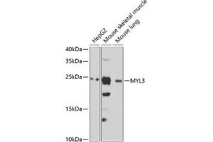 Western blot analysis of extracts of various cell lines, using MYL3 antibody (ABIN6133198, ABIN6144249, ABIN6144250 and ABIN6222363) at 1:1000 dilution. (MYL3/CMLC1 anticorps  (AA 1-195))