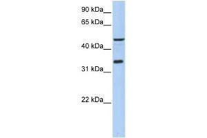 WB Suggested Anti-PIP3-E Antibody Titration:  0. (ICEF1 anticorps  (Middle Region))