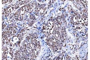 IHC analysis of BAT3/BAG6 using anti-BAT3/BAG6 antibody (ABIN6719601). (BAT3 anticorps)
