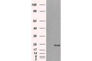 Western Blotting (WB) image for anti-Dicarbonyl/L-Xylulose Reductase (DCXR) antibody (ABIN1497784) (DCXR anticorps)