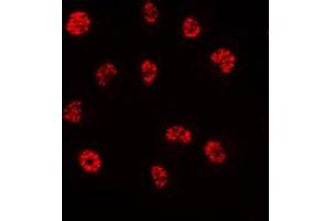 Immunofluorescent analysis of PE2 staining in HeLa cells.